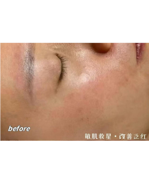 护理前