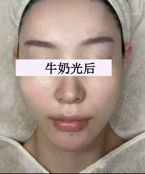 护理后