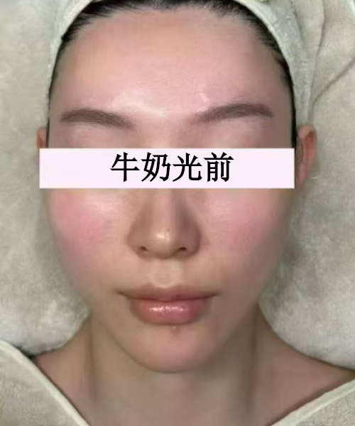 护理前