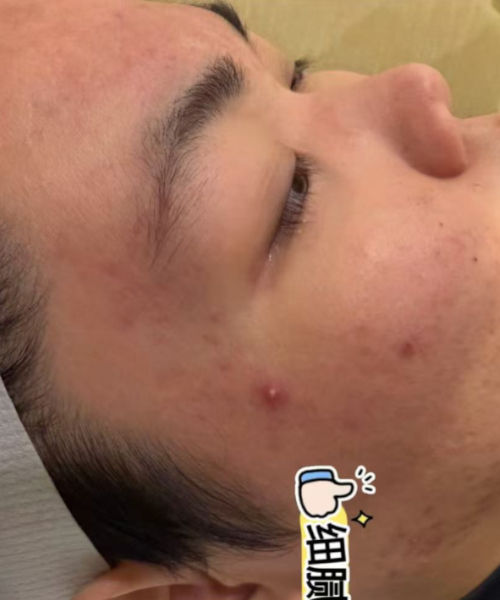 护理后